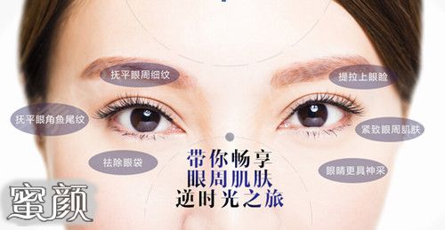 https://img.miyanlife.com/mnt/Editor/2021-01-27/60116665916f3.jpg
