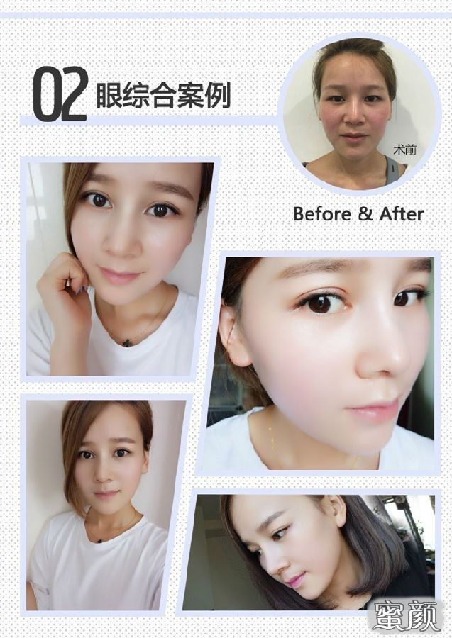 https://img.miyanlife.com/mnt/Editor/2021-01-27/601176a7eeb93.jpg