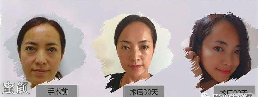 https://img.miyanlife.com/mnt/Editor/2021-01-29/60137537b0935.jpg