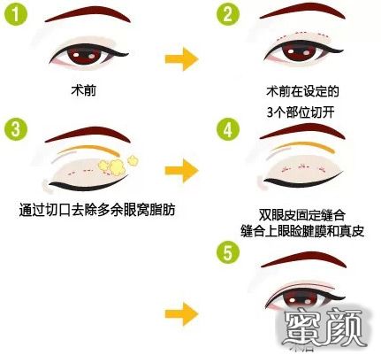 https://img.miyanlife.com/mnt/Editor/2021-02-08/60212b84c0413.jpg