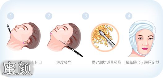 https://img.miyanlife.com/mnt/Editor/2021-02-08/60214c297f62f.jpg