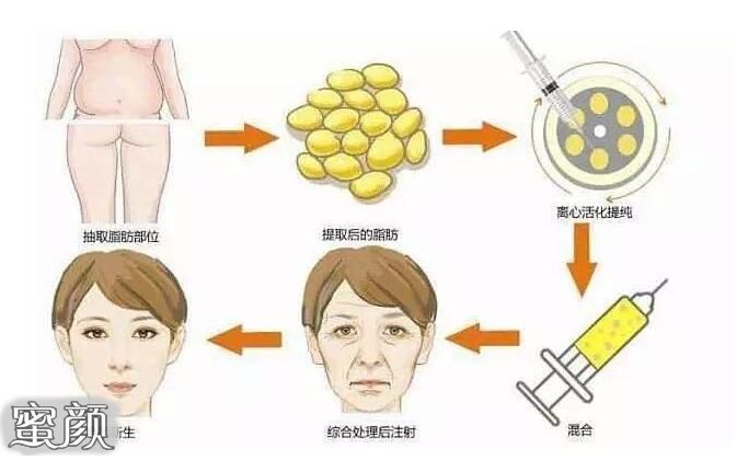 https://img.miyanlife.com/mnt/Editor/2021-02-13/6027a8c955933.jpg