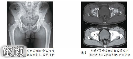 案例图片