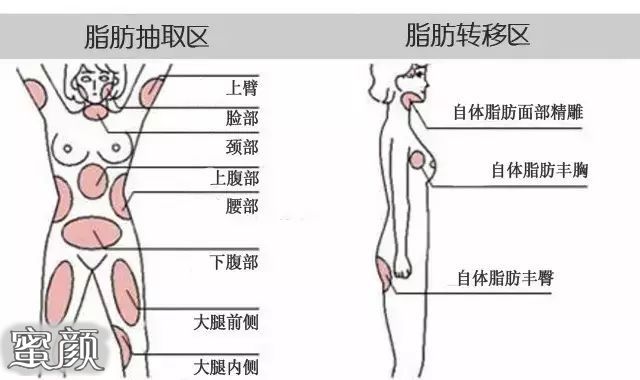 案例图片