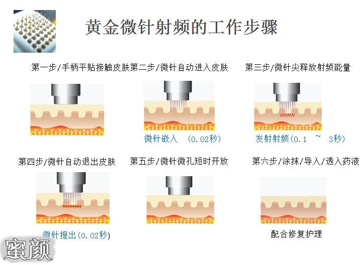 案例图片