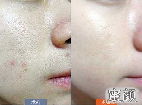 https://img.miyanlife.com/mnt/Editor/2021-03-04/6041017aa5201.jpg