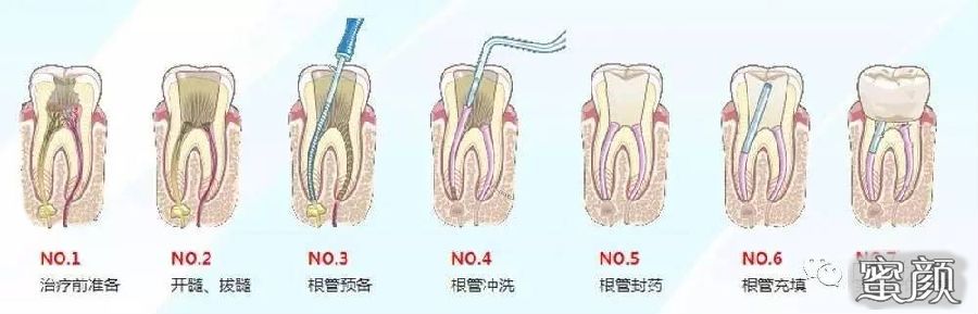 案例图片