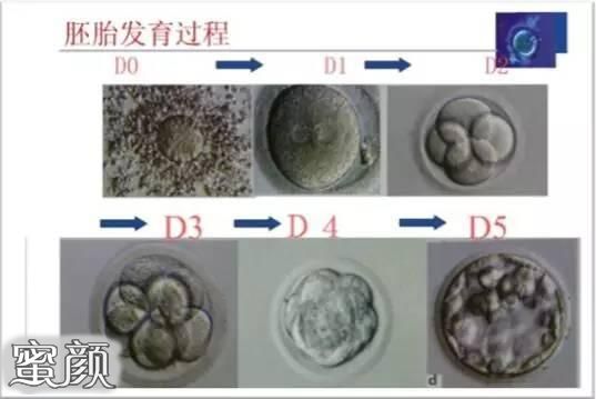 案例图片