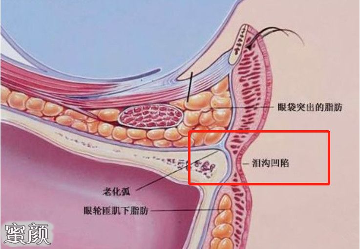 案例图片