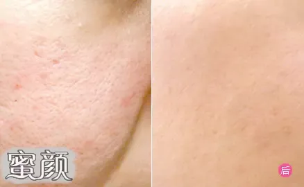 https://img.miyanlife.com/mnt/Editor/2021-03-09/604752997ce56.jpg