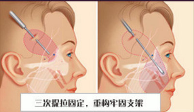 https://img.miyanlife.com/mnt/Editor/2021-03-10/6048be004901e.jpg