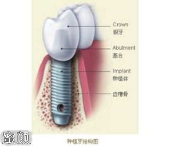 案例图片