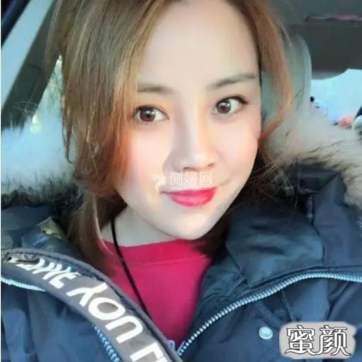 https://img.miyanlife.com/mnt/Editor/2021-03-15/604f207081689.jpg
