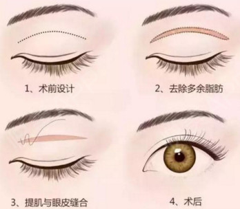 https://img.miyanlife.com/mnt/Editor/2021-03-18/60532a87a6b88.jpg