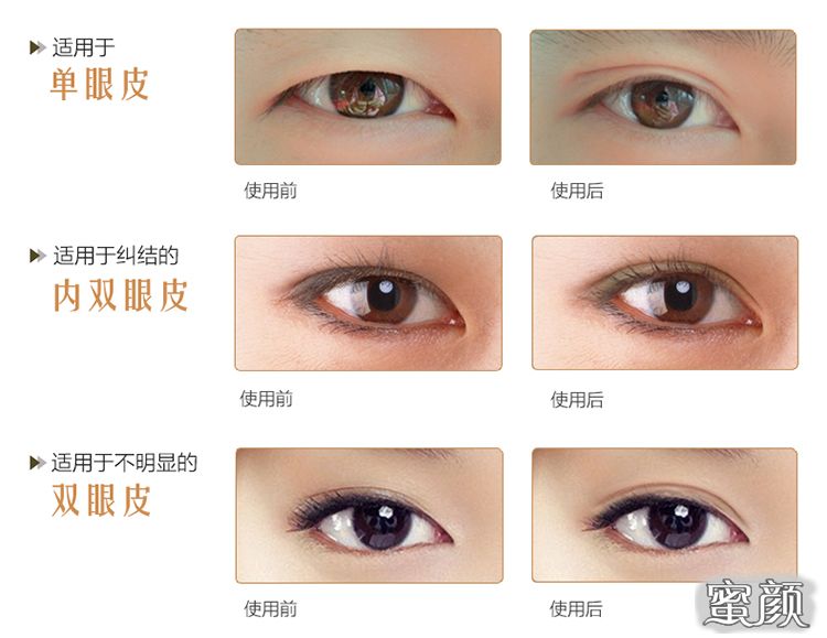 https://img.miyanlife.com/mnt/Editor/2021-03-18/60532a9cc4fdc.jpg