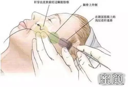 https://img.miyanlife.com/mnt/Editor/2021-03-20/6055bd8c65776.jpg