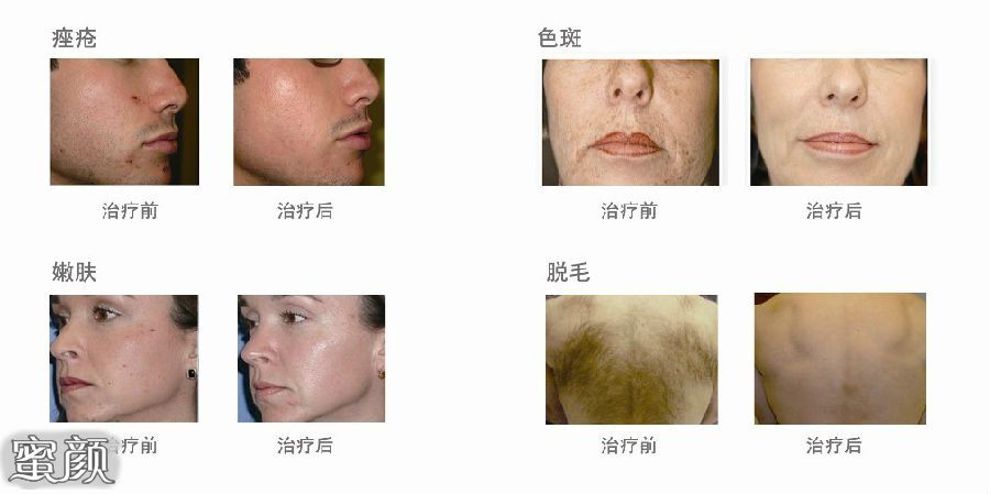 https://img.miyanlife.com/mnt/Editor/2021-03-20/6055ead946beb.jpg