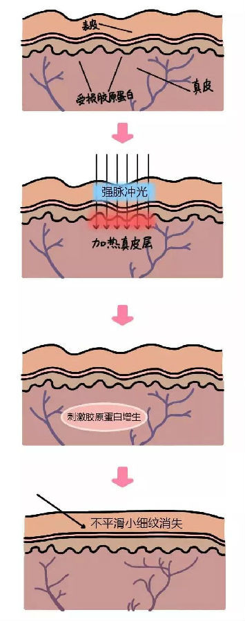 https://img.miyanlife.com/mnt/Editor/2021-03-21/6056ab4a1d9ff.jpg