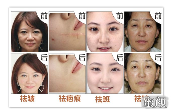 https://img.miyanlife.com/mnt/Editor/2021-03-22/60586d68567bf.jpg
