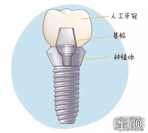 案例图片