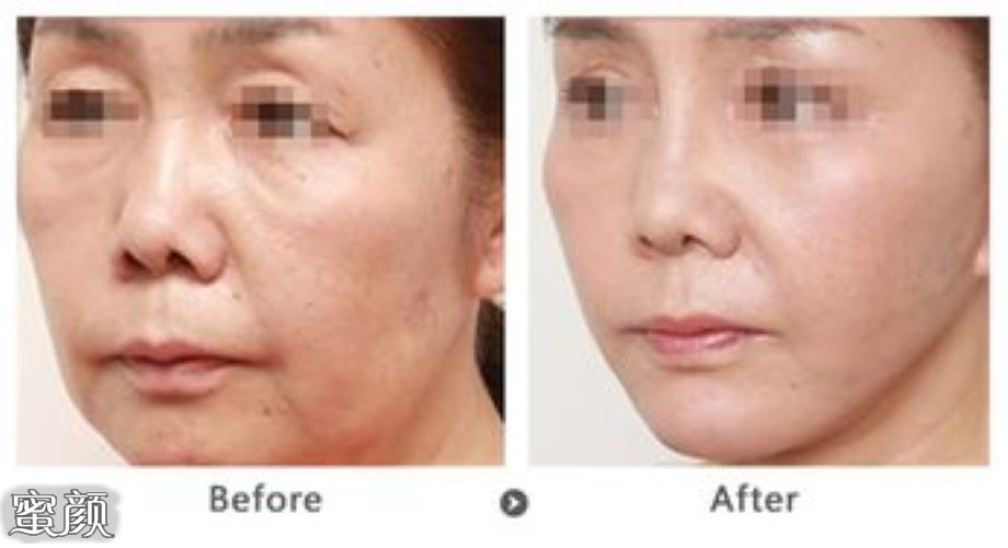 https://img.miyanlife.com/mnt/Editor/2021-03-27/605ec82f6adae.jpg