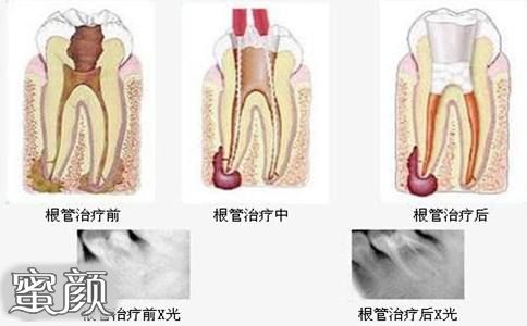 案例图片