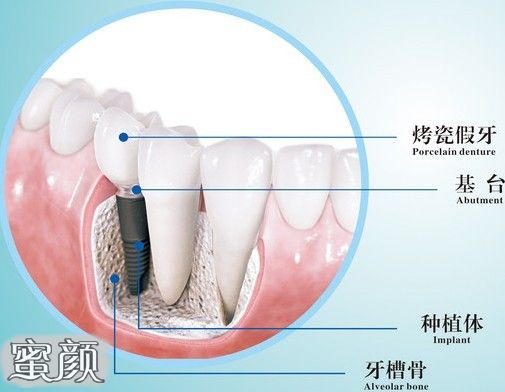 案例图片