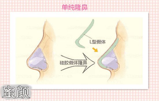 案例图片