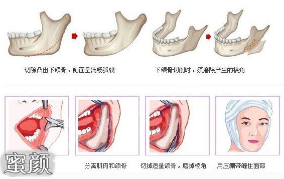 案例图片