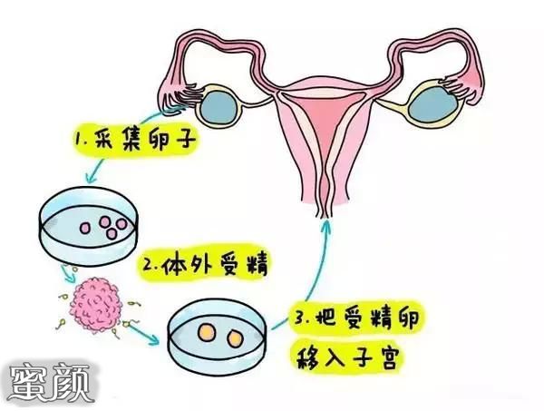 https://img.miyanlife.com/mnt/Editor/2021-04-11/607240c5a8103.jpg