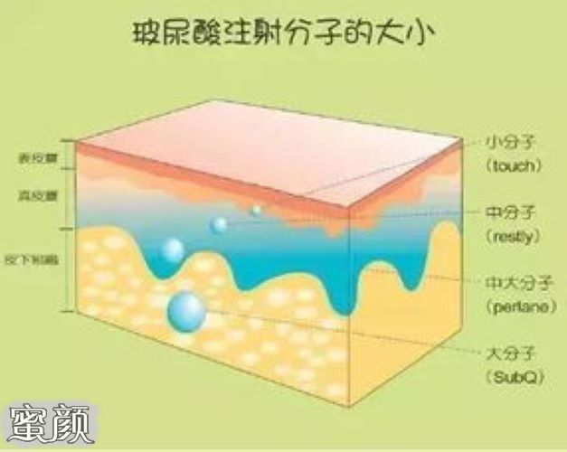 https://img.miyanlife.com/mnt/Editor/2021-04-11/607289d31f56e.jpg