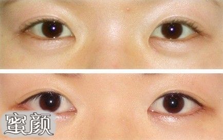 https://img.miyanlife.com/mnt/Editor/2021-04-18/607c32b3b266e.jpg