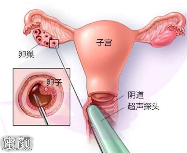 案例图片