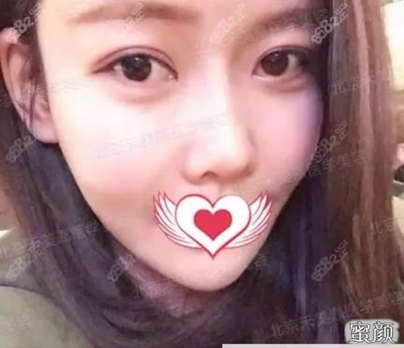 https://img.miyanlife.com/mnt/Editor/2021-04-24/608396fa78655.jpg