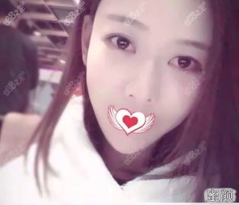 https://img.miyanlife.com/mnt/Editor/2021-04-24/6083970ff154f.jpg