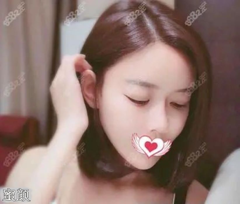 https://img.miyanlife.com/mnt/Editor/2021-04-24/608397192c523.jpg
