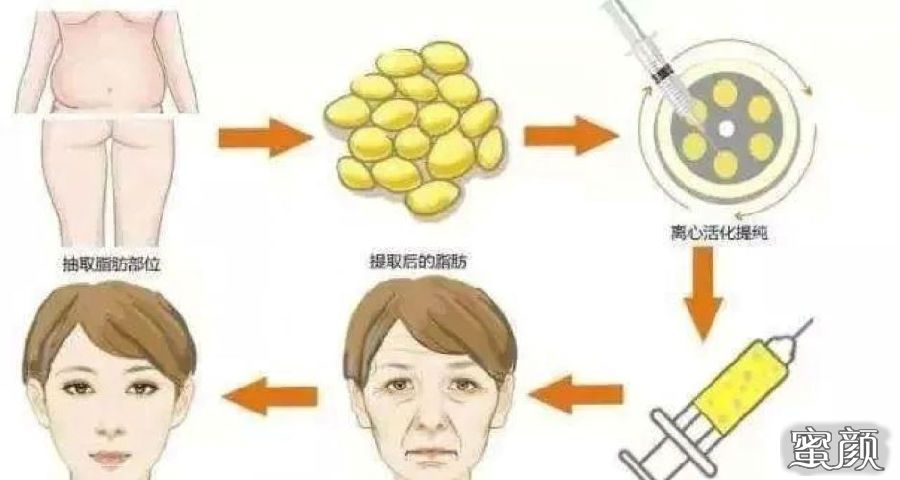 https://img.miyanlife.com/mnt/Editor/2021-04-24/6083ce022aa82.jpg