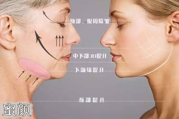 https://img.miyanlife.com/mnt/Editor/2021-04-27/6088126be7a34.jpg