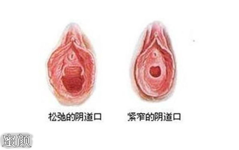 https://img.miyanlife.com/mnt/Editor/2021-04-28/608969a96aff1.jpg