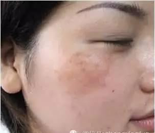 https://img.miyanlife.com/mnt/Editor/2021-04-28/60897063e9c05.jpg