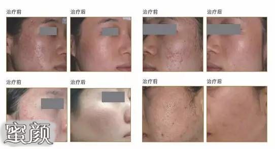 https://img.miyanlife.com/mnt/Editor/2021-04-29/6089ea411234d.jpg