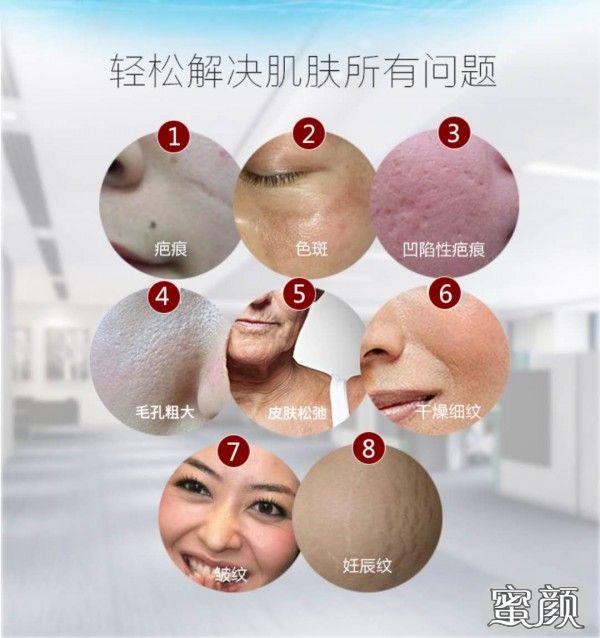 https://img.miyanlife.com/mnt/Editor/2021-05-04/6090e9fc482a4.jpg