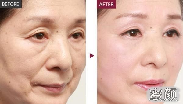 https://img.miyanlife.com/mnt/Editor/2021-05-04/60914cf27e25f.jpg