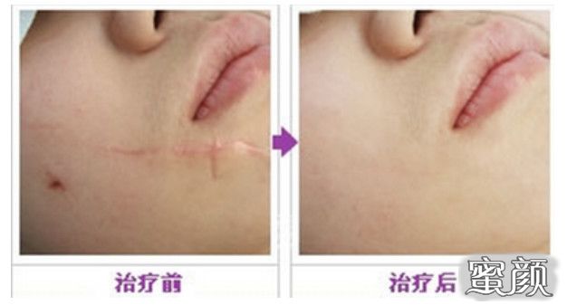 https://img.miyanlife.com/mnt/Editor/2021-05-04/609154c8ade61.jpg