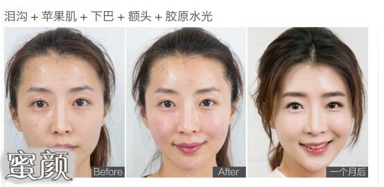 https://img.miyanlife.com/mnt/Editor/2021-05-09/60972fd7922b4.jpg