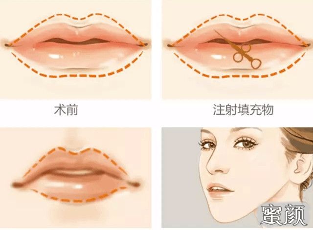 https://img.miyanlife.com/mnt/Editor/2021-05-09/6097303c863f1.jpg
