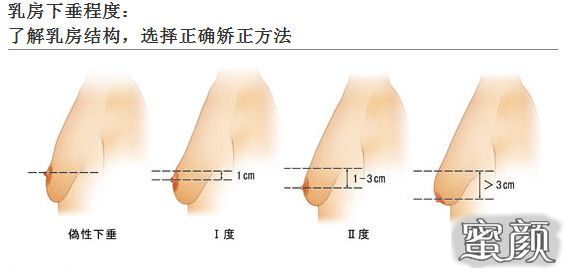 案例图片