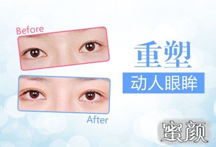 https://img.miyanlife.com/mnt/Editor/2021-05-12/609b631ab6543.jpg