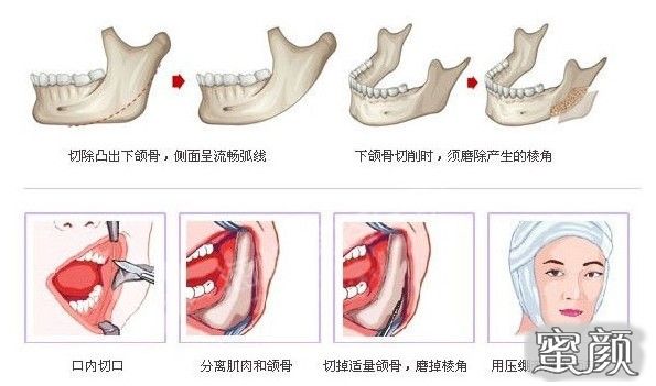 案例图片