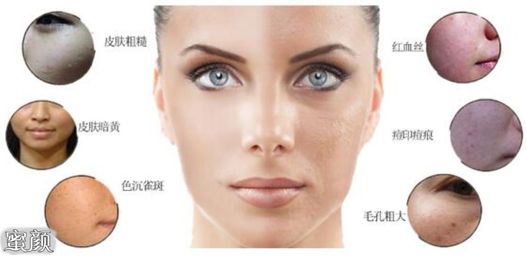 https://img.miyanlife.com/mnt/Editor/2021-05-17/60a20e5fa9d9f.jpg